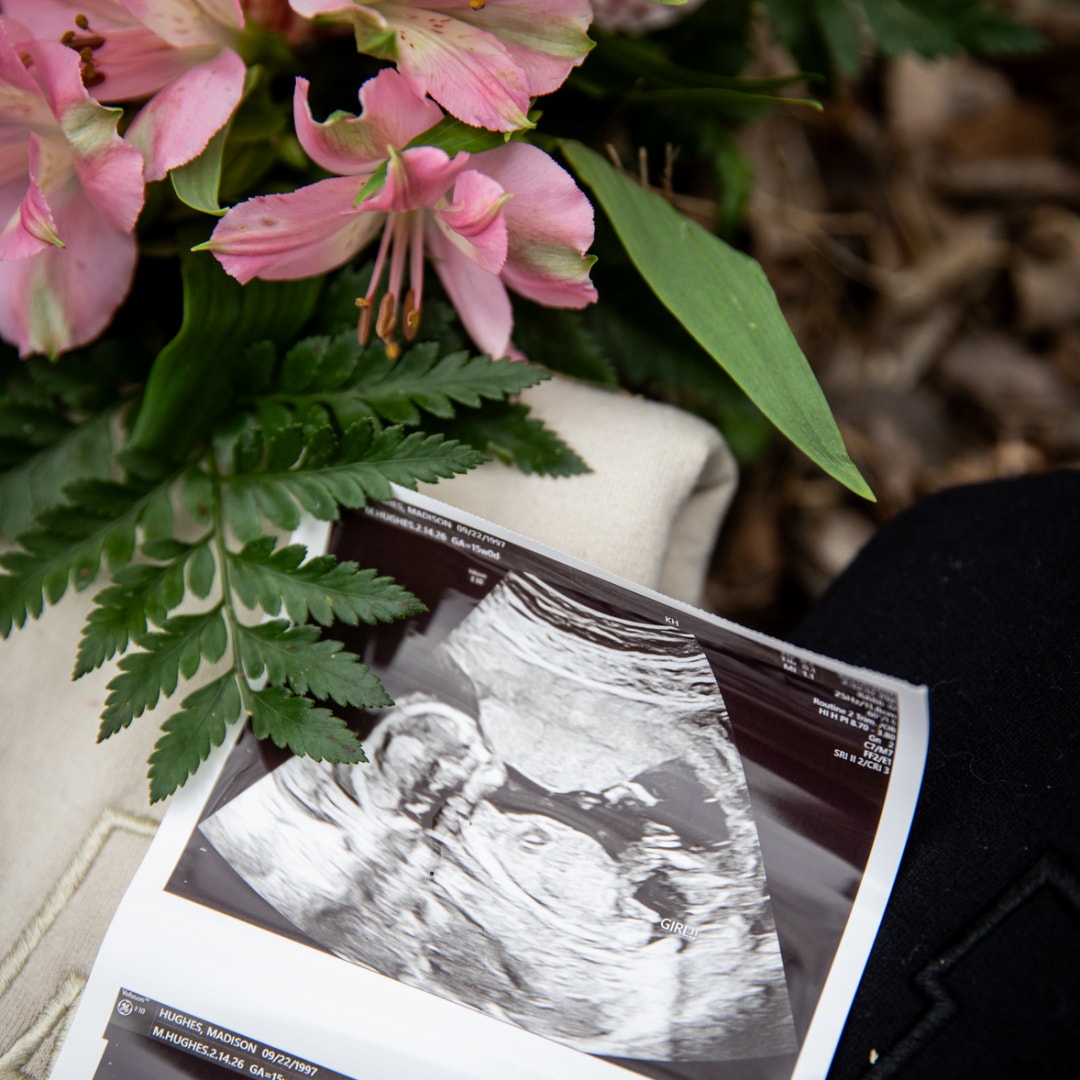 Photo shared by Madison for their Babylist baby registry.
