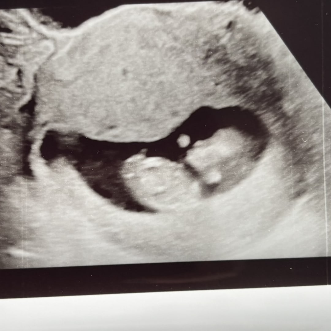 Photo shared by Melissa and Jack for their Babylist baby registry.