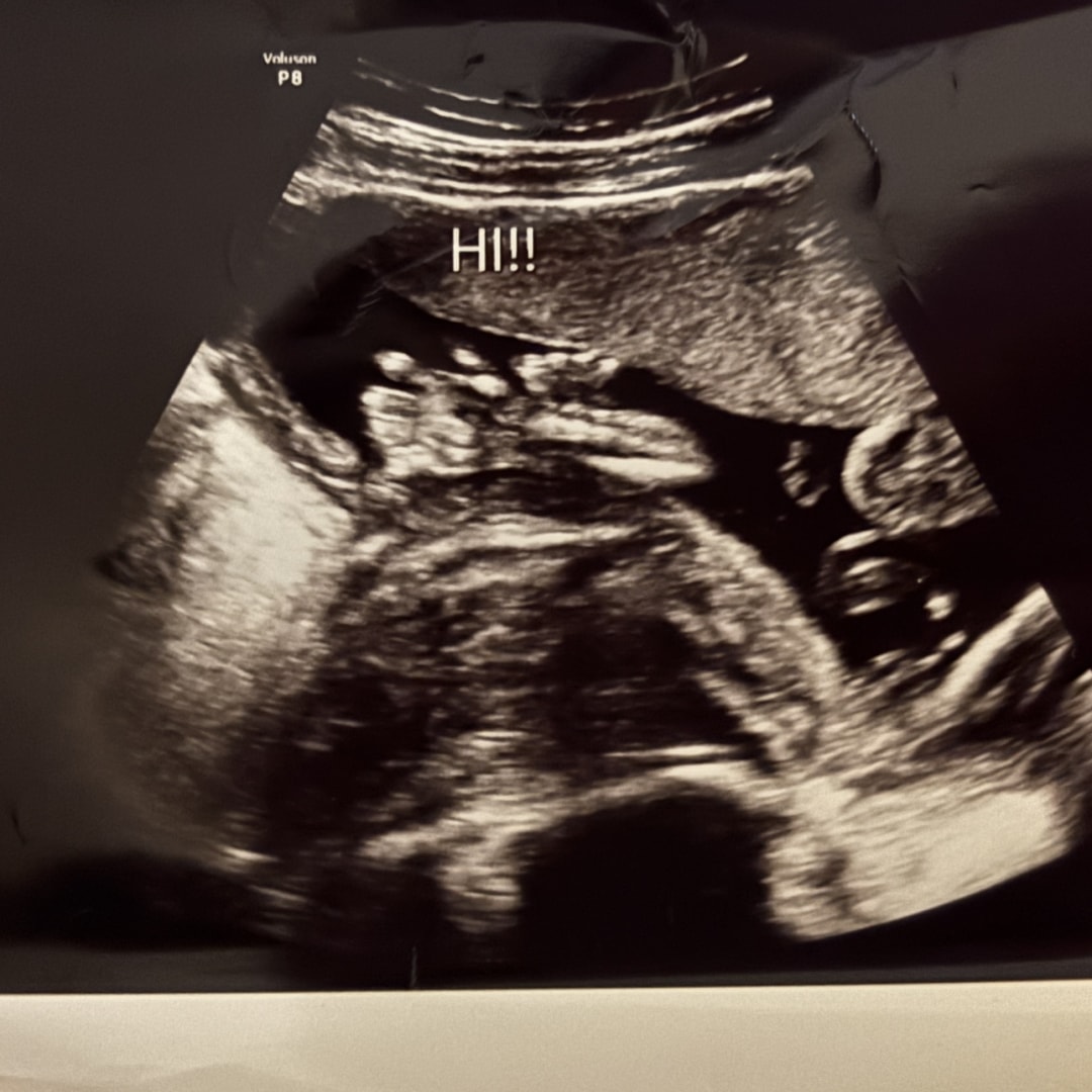 Photo shared by Cortney for their Babylist baby registry.