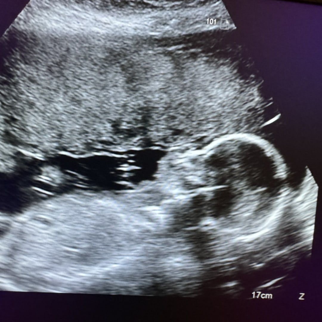 Photo shared by Leydi for their Babylist baby registry.