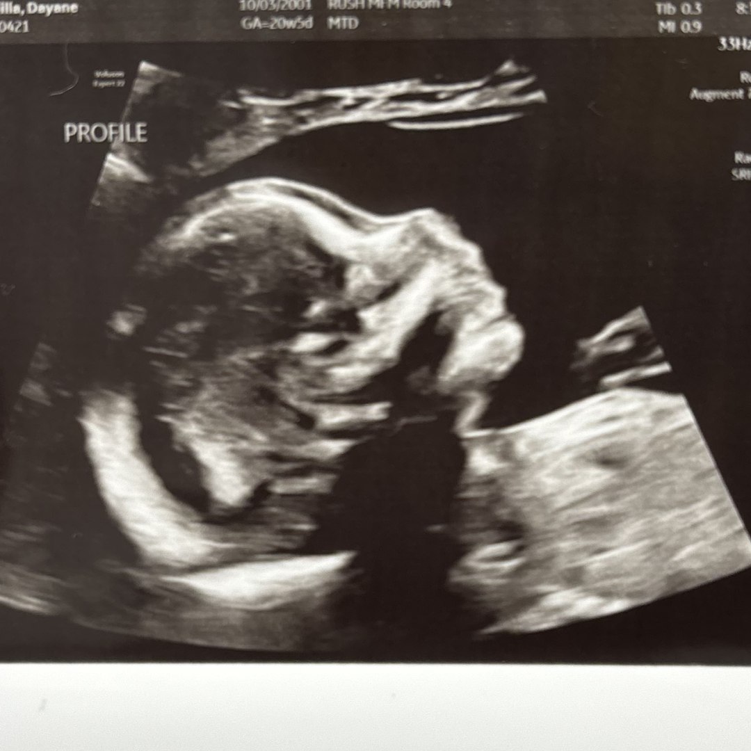 Photo shared by Dayane for their Babylist baby registry.