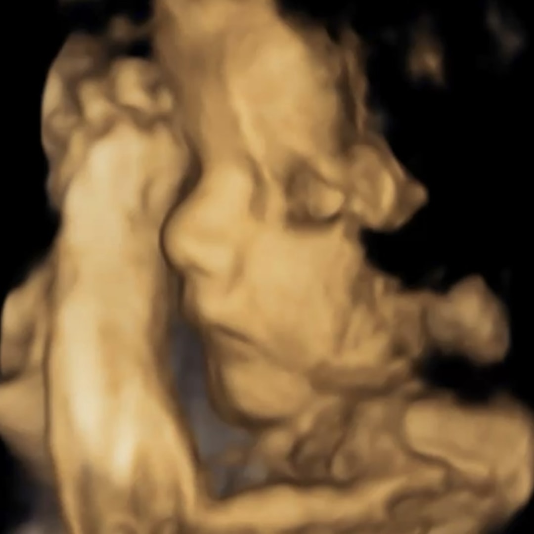 Photo shared by Anne for their Babylist baby registry.