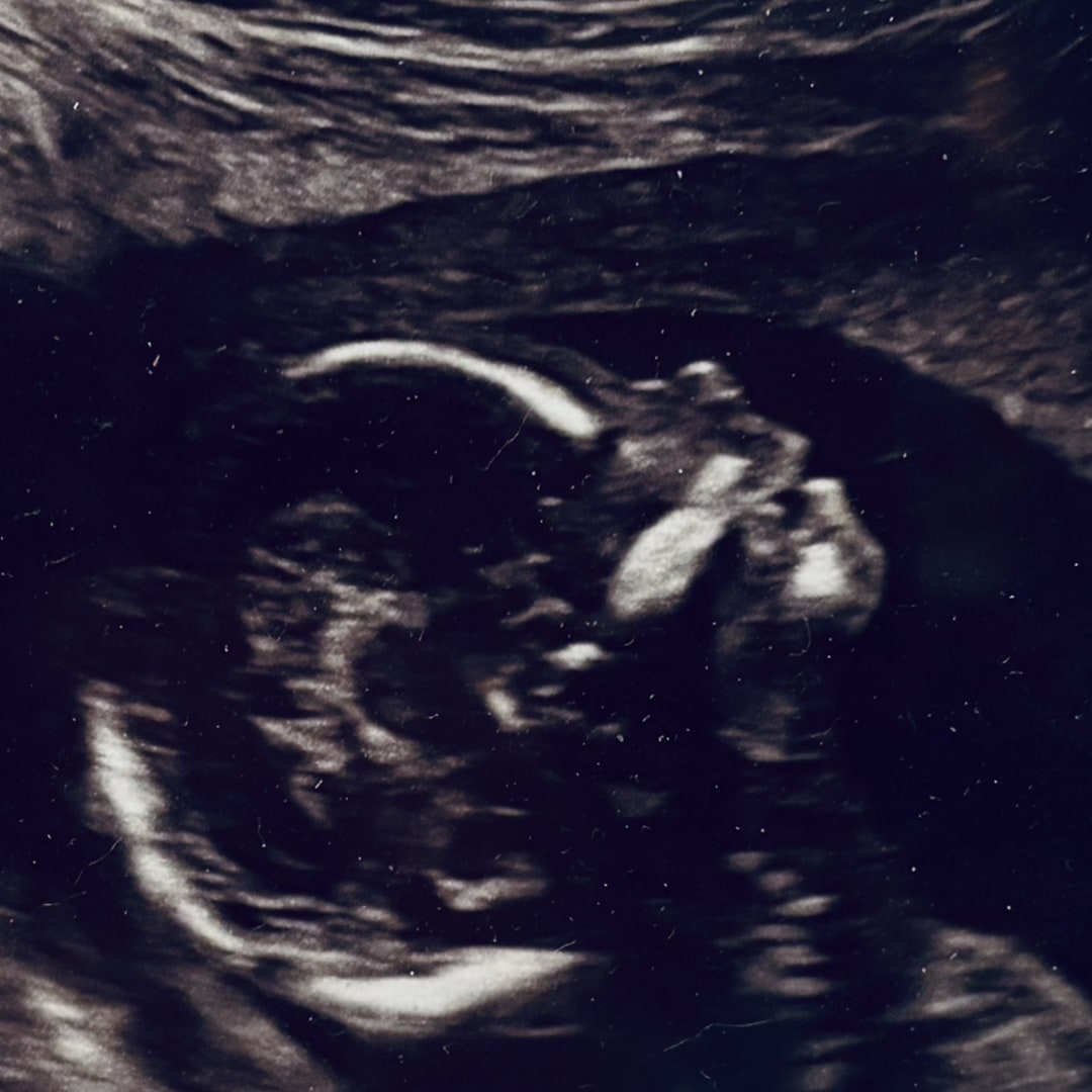 Photo shared by Abigail for their Babylist baby registry.
