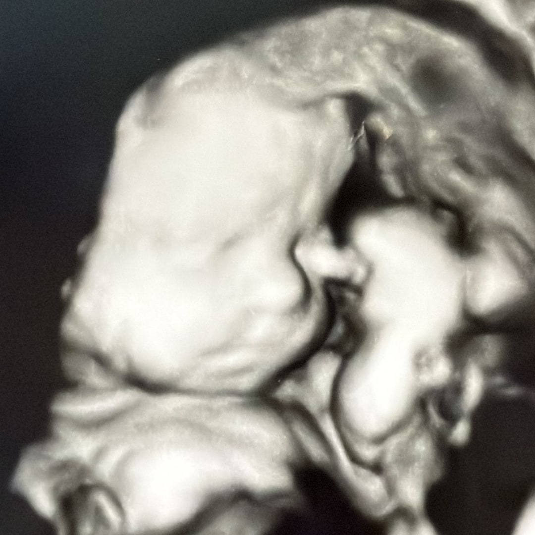 Photo shared by Amanda for their Babylist baby registry.