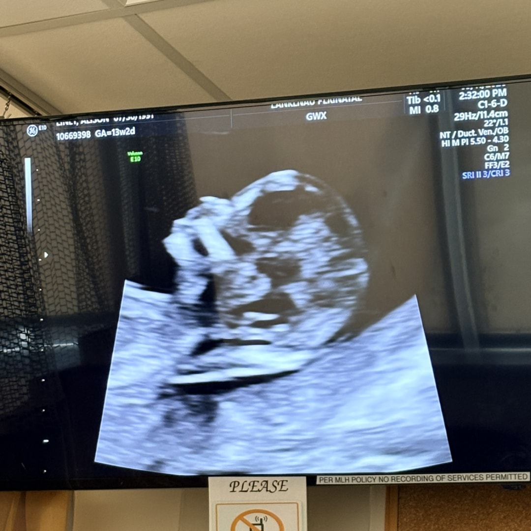 Photo shared by Alison for their Babylist baby registry.