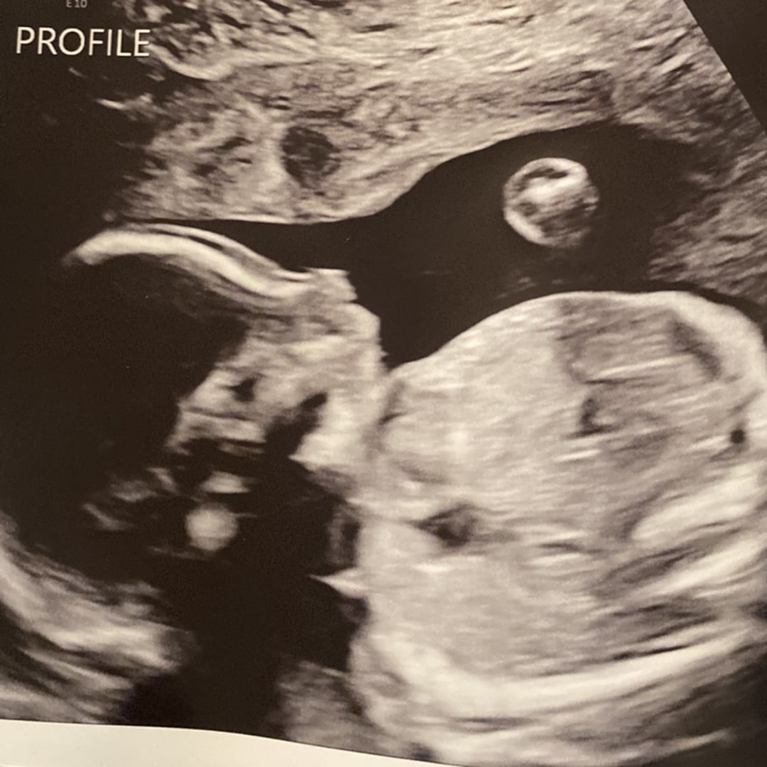 Photo shared by Olivia for their Babylist baby registry.