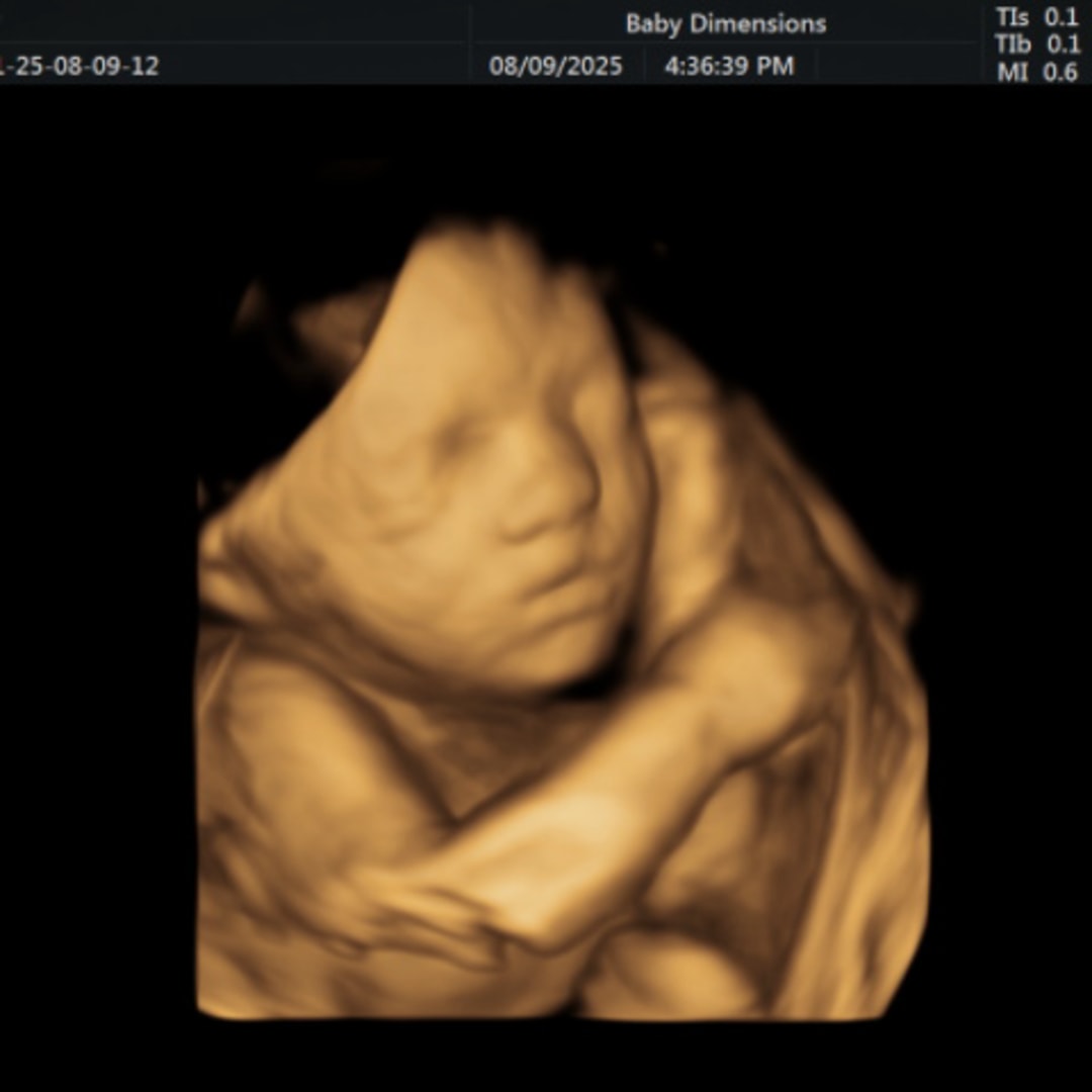Photo shared by Morgan for their Babylist baby registry.