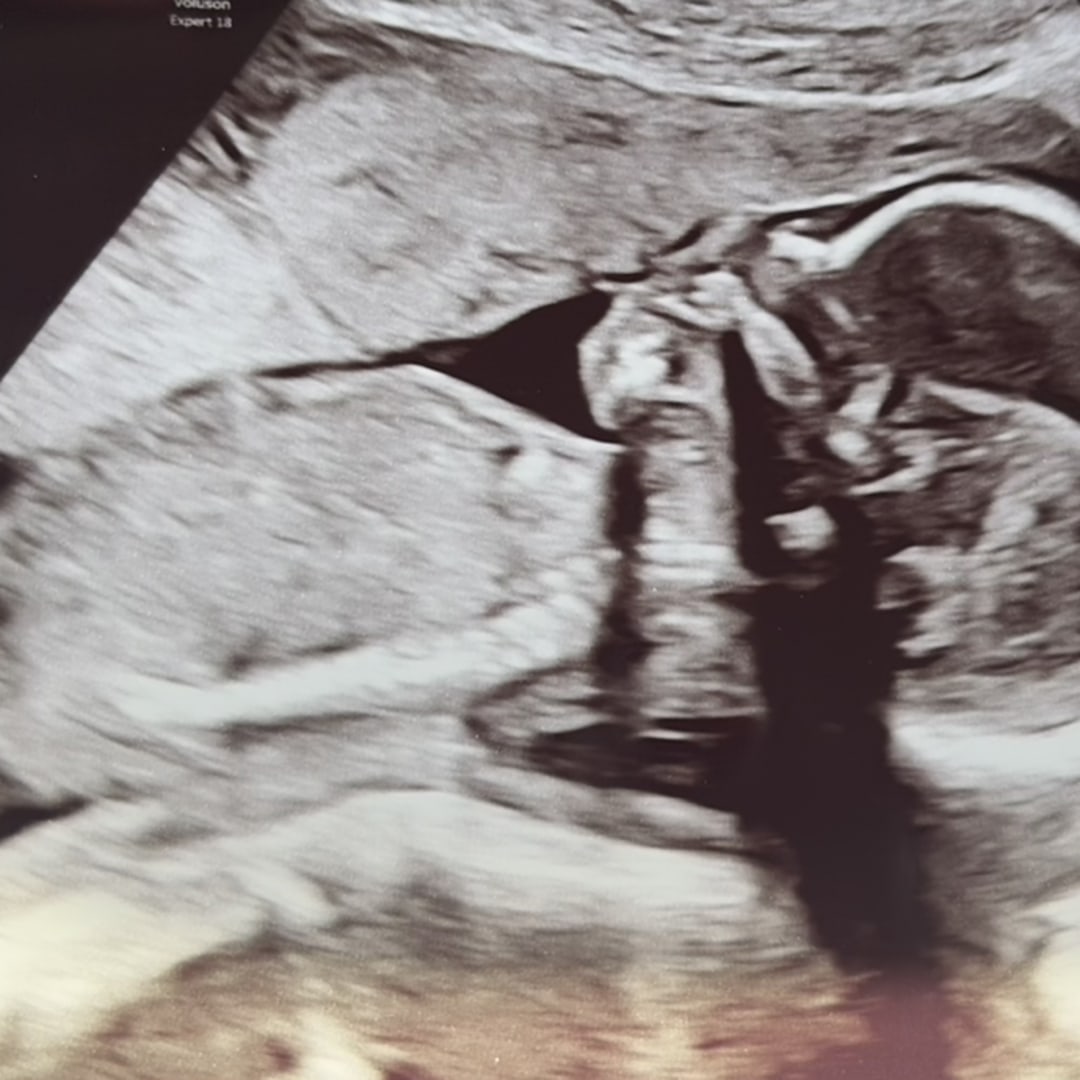 Photo shared by Cayleigh for their Babylist baby registry.