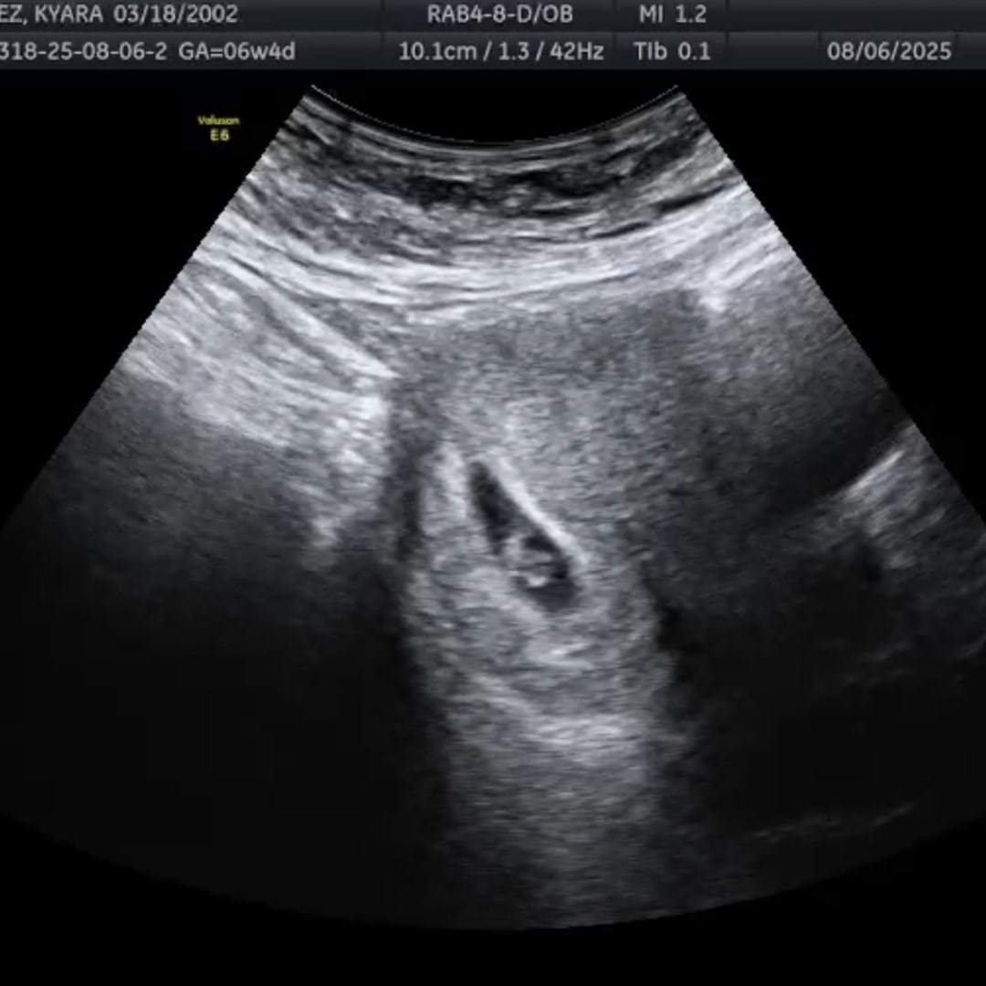 Photo shared by Kyara for their Babylist baby registry.