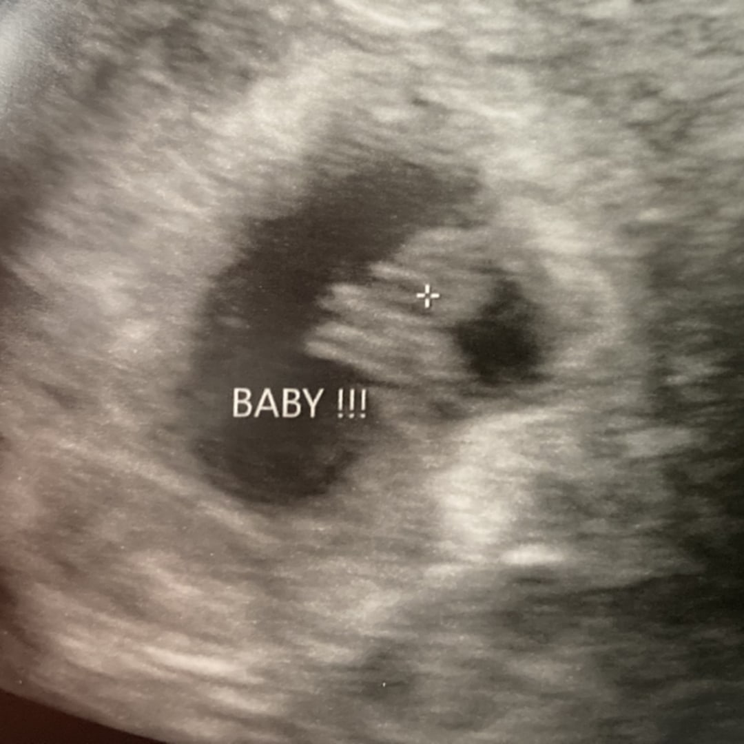 Photo shared by Laura for their Babylist baby registry.