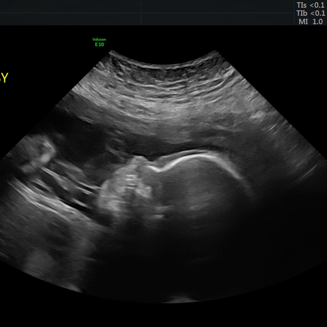 Photo shared by Leah for their Babylist baby registry.