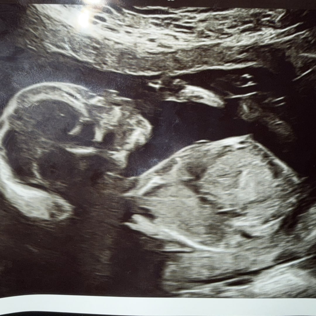 Photo shared by Esther for their Babylist baby registry.