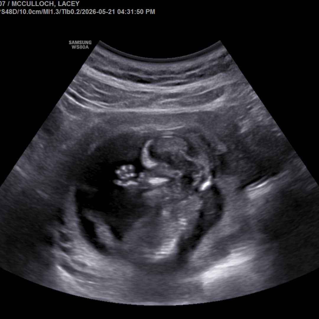 Photo shared by Lacey for their Babylist baby registry.