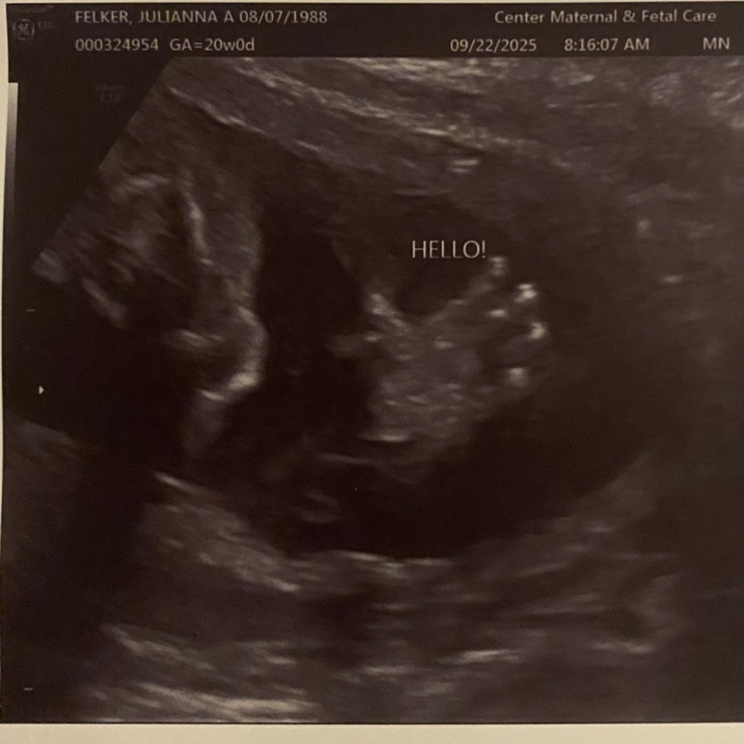 Photo shared by Julianna for their Babylist baby registry.