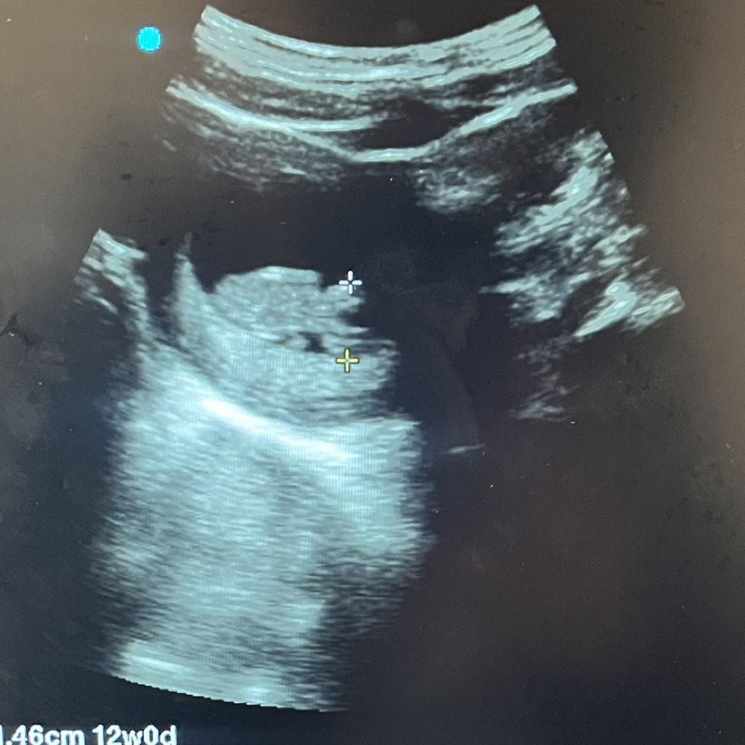 Photo shared by Marissa for their Babylist baby registry.