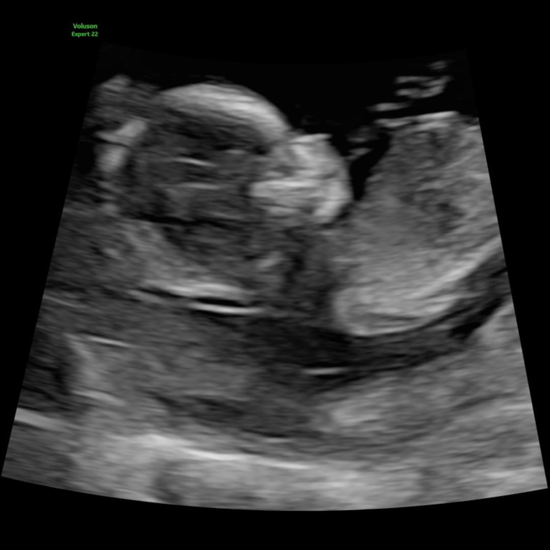 Photo shared by Rylan for their Babylist baby registry.