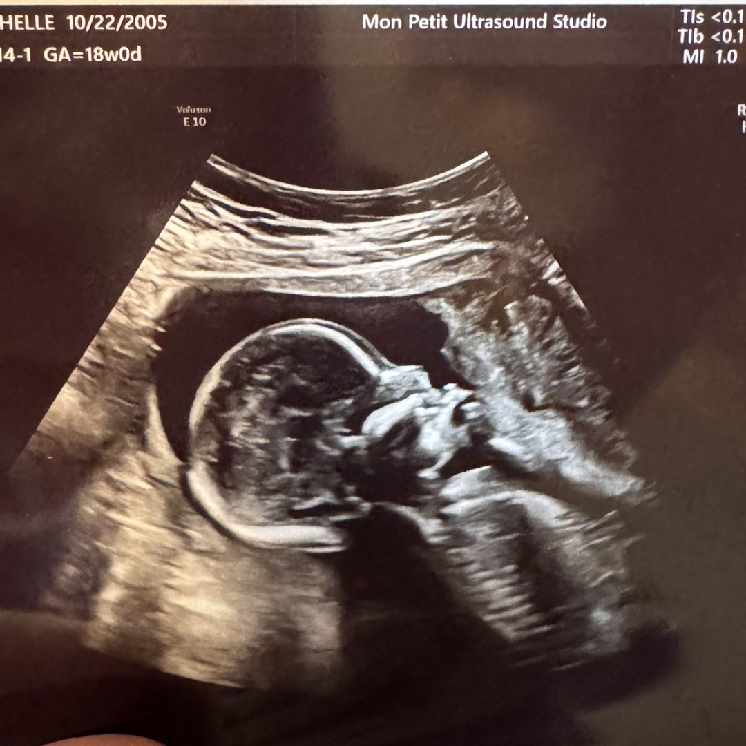 Photo shared by Michelle for their Babylist baby registry.