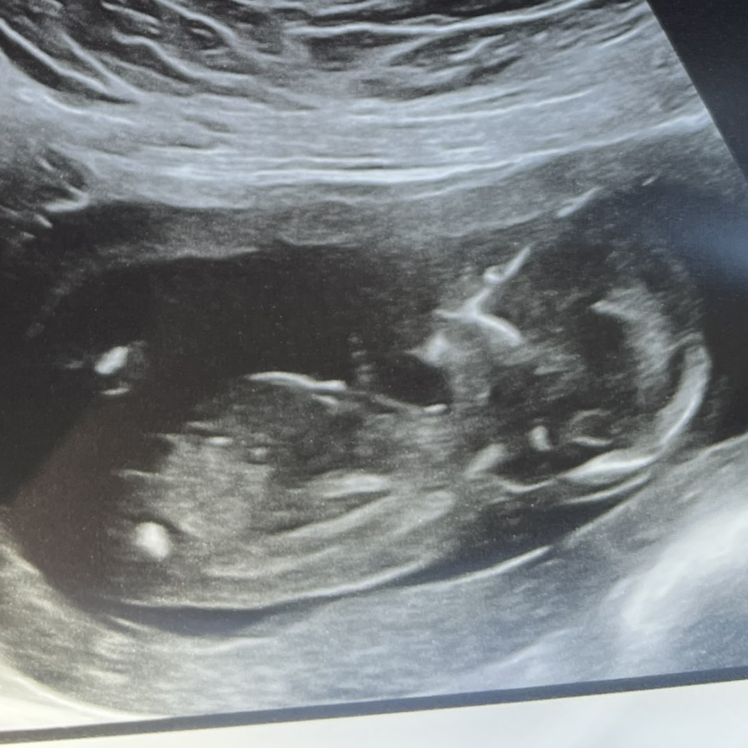 Photo shared by Lacey for their Babylist baby registry.