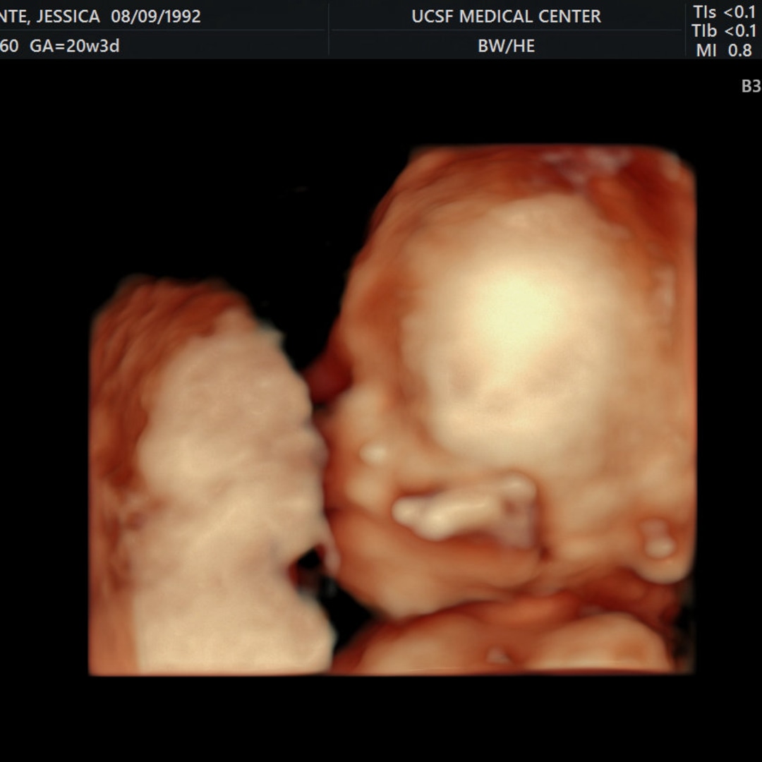 Photo shared by Jessica for their Babylist baby registry.