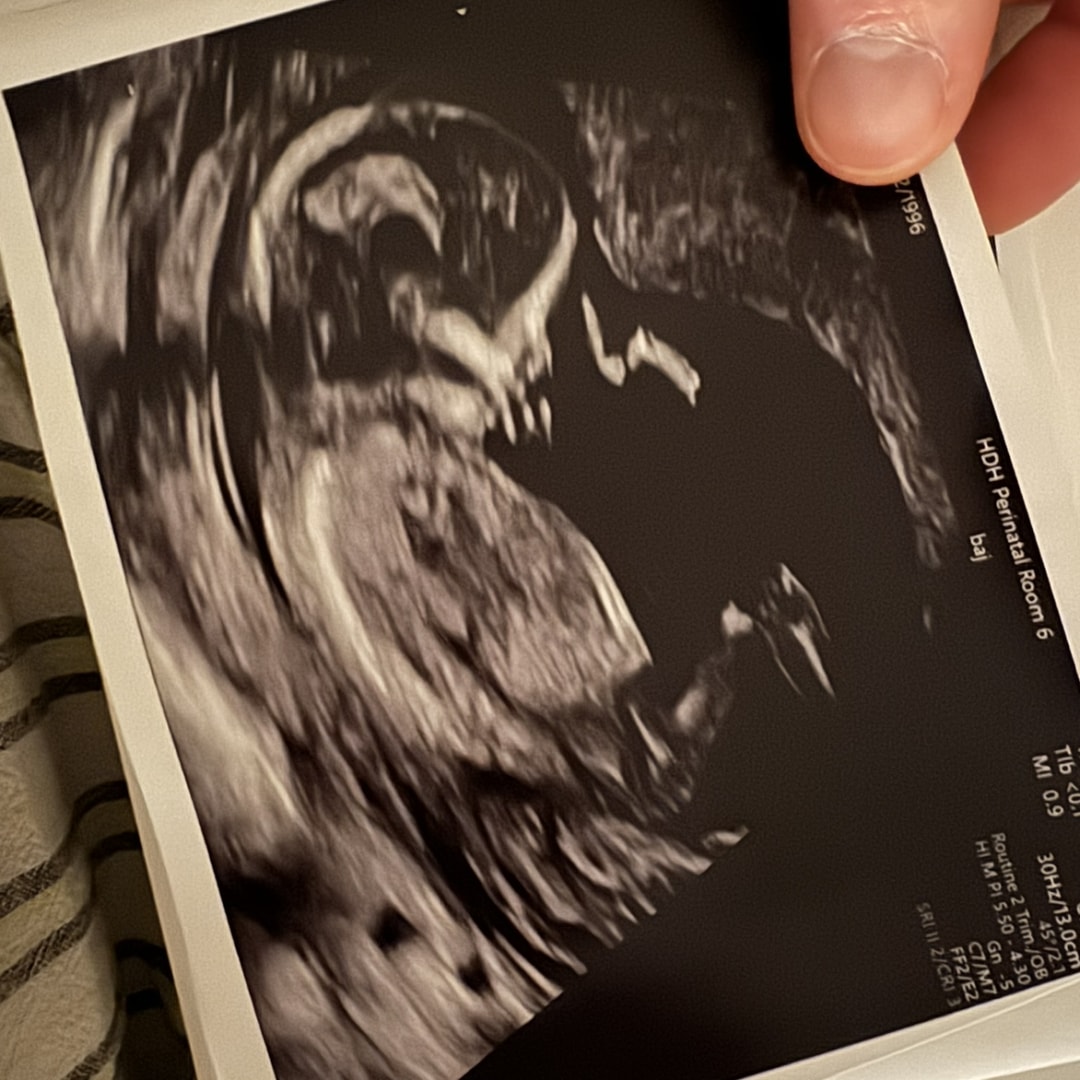 Photo shared by Michaela for their Babylist baby registry.