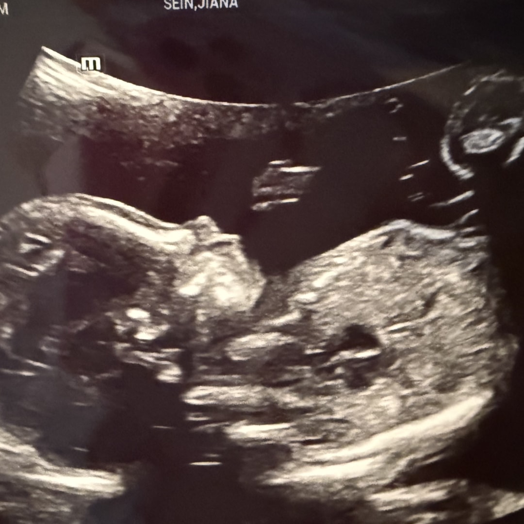 Photo shared by Jiana for their Babylist baby registry.