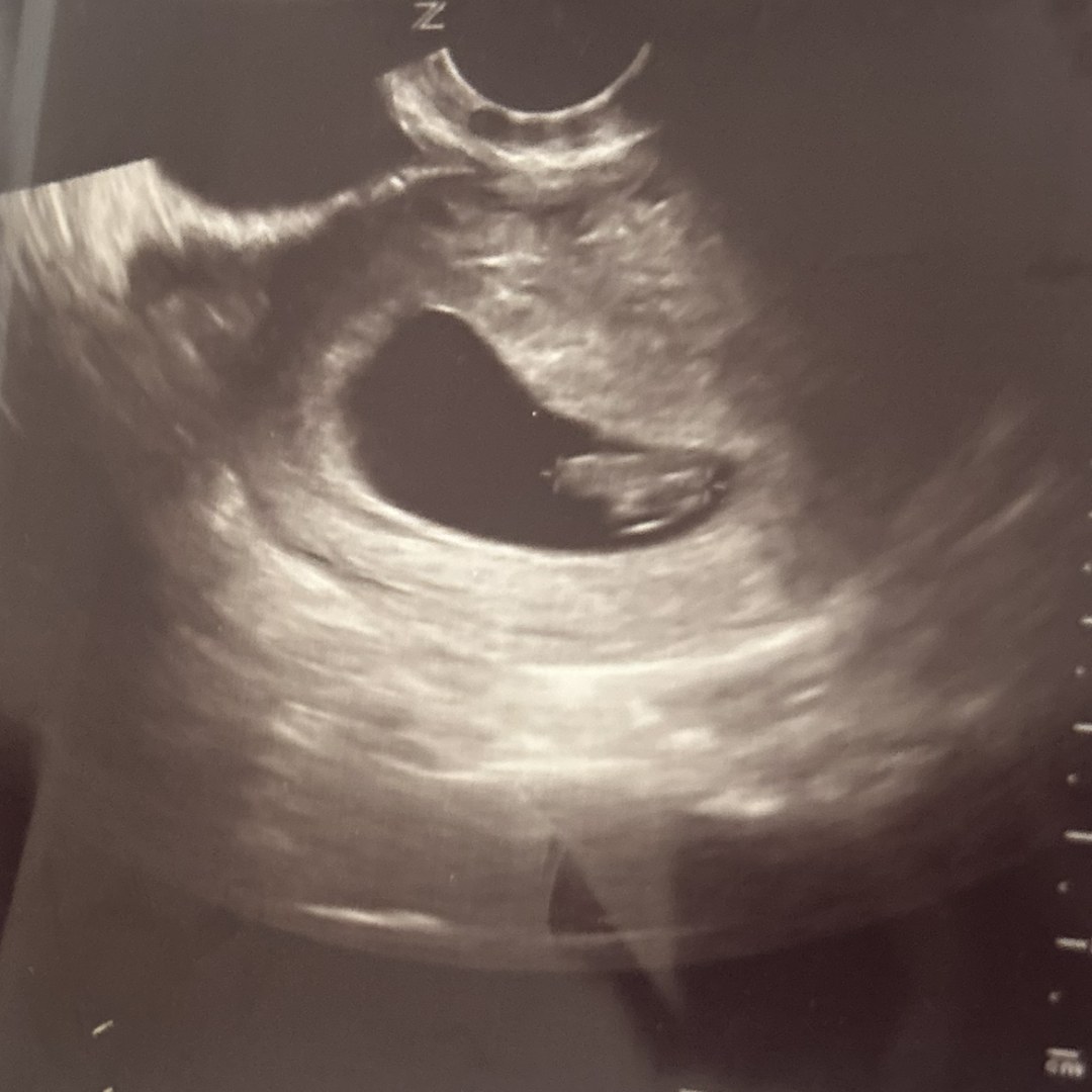 Photo shared by Jill for their Babylist baby registry.