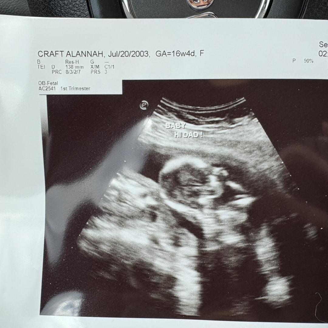 Photo shared by Alannah for their Babylist baby registry.