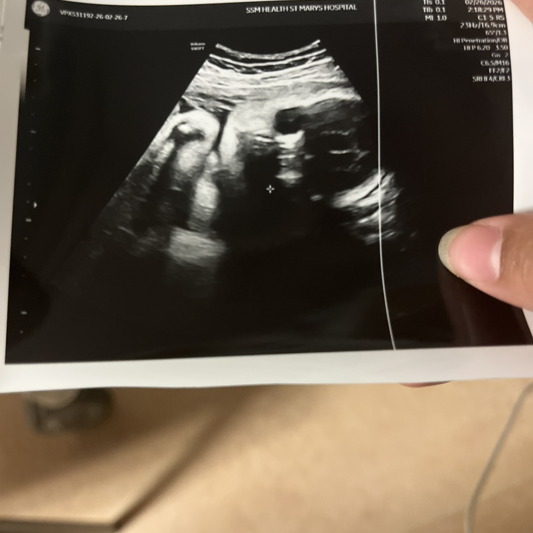 Photo shared by Hailey for their Babylist baby registry.