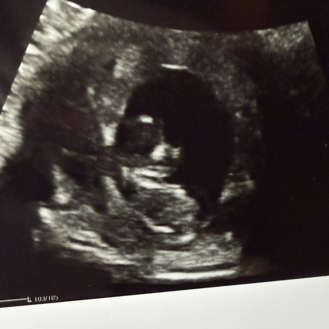 Photo shared by Kayla for their Babylist baby registry.