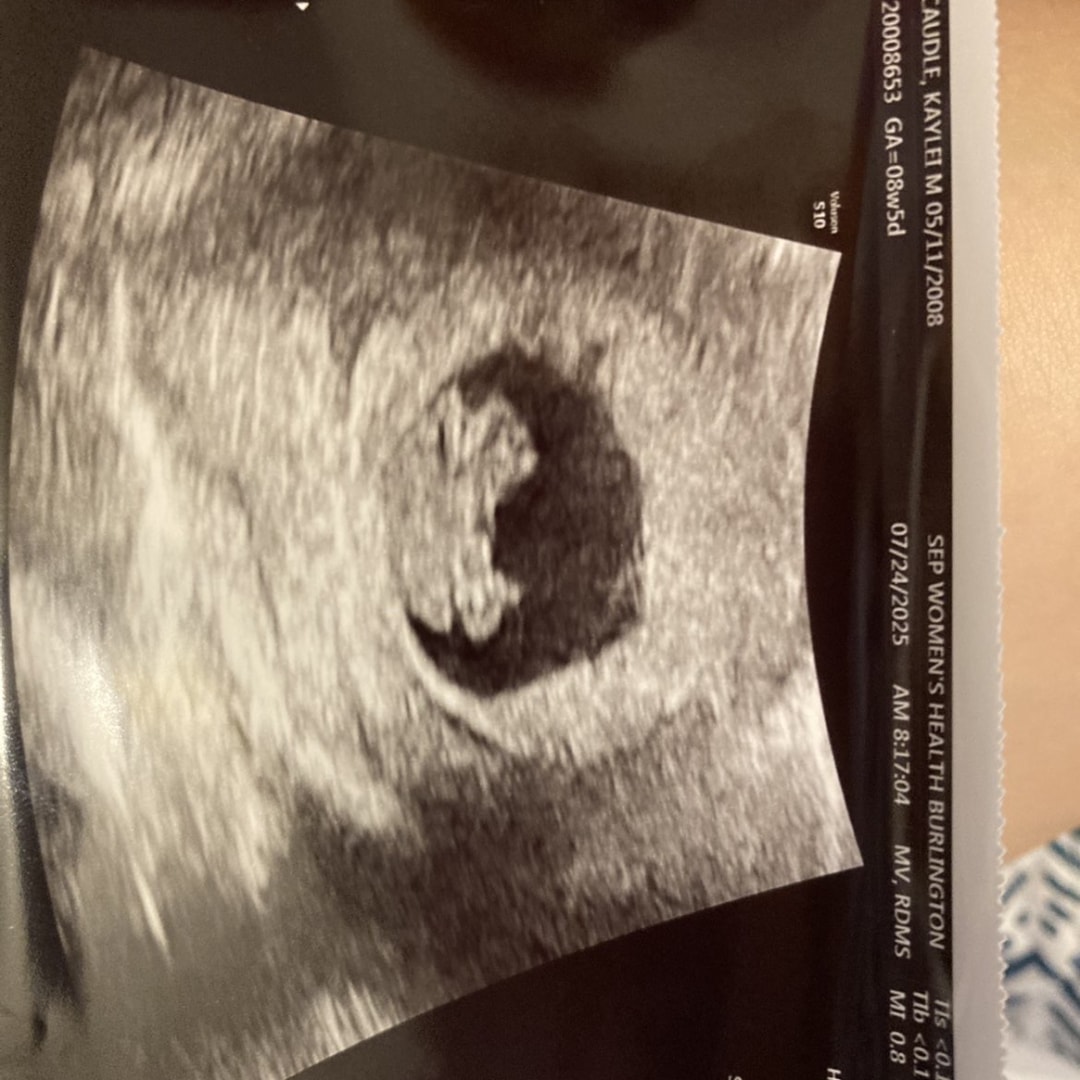 Photo shared by Kaylei for their Babylist baby registry.