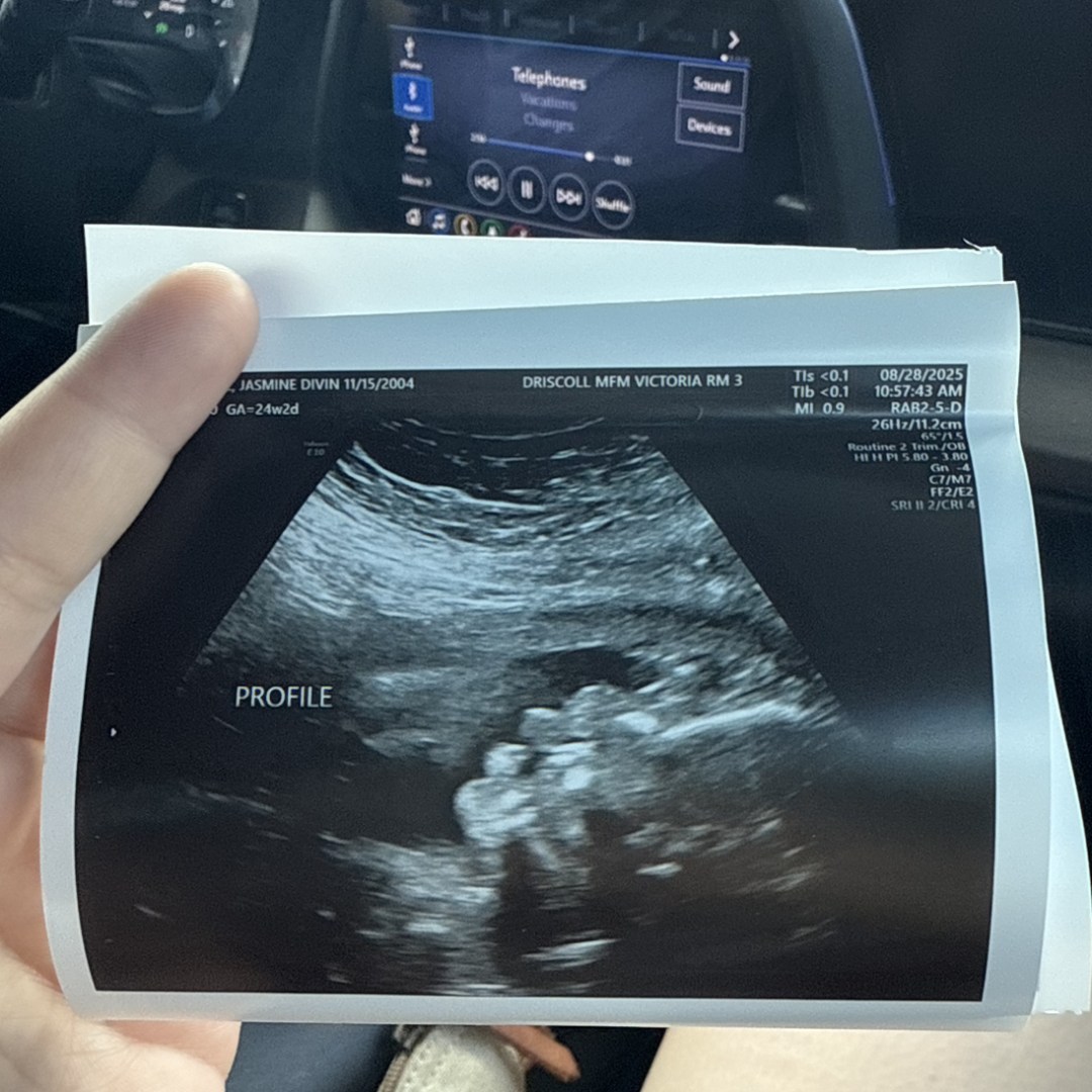 Photo shared by Jasmine for their Babylist baby registry.