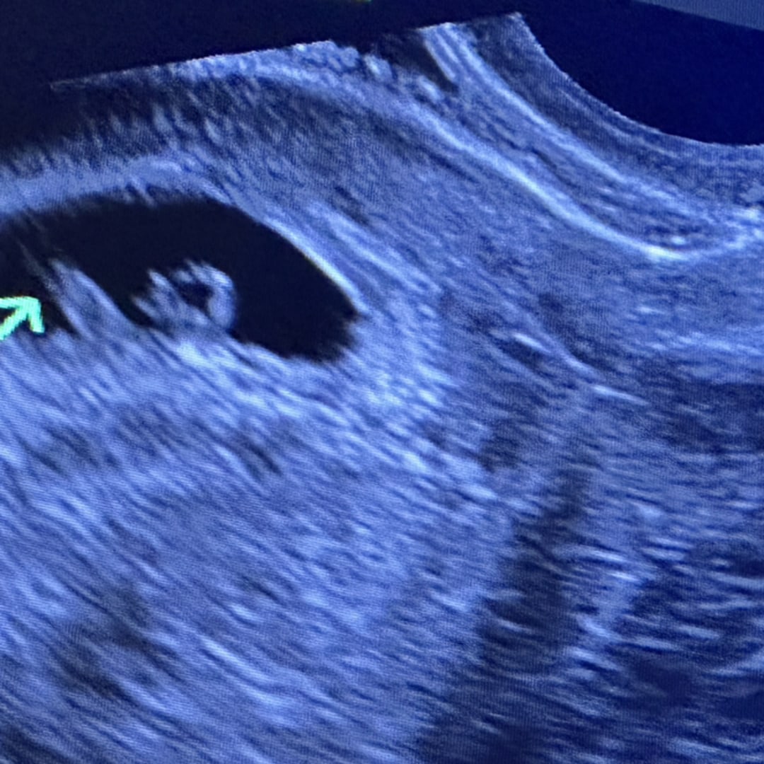 Photo shared by Rachel for their Babylist baby registry.