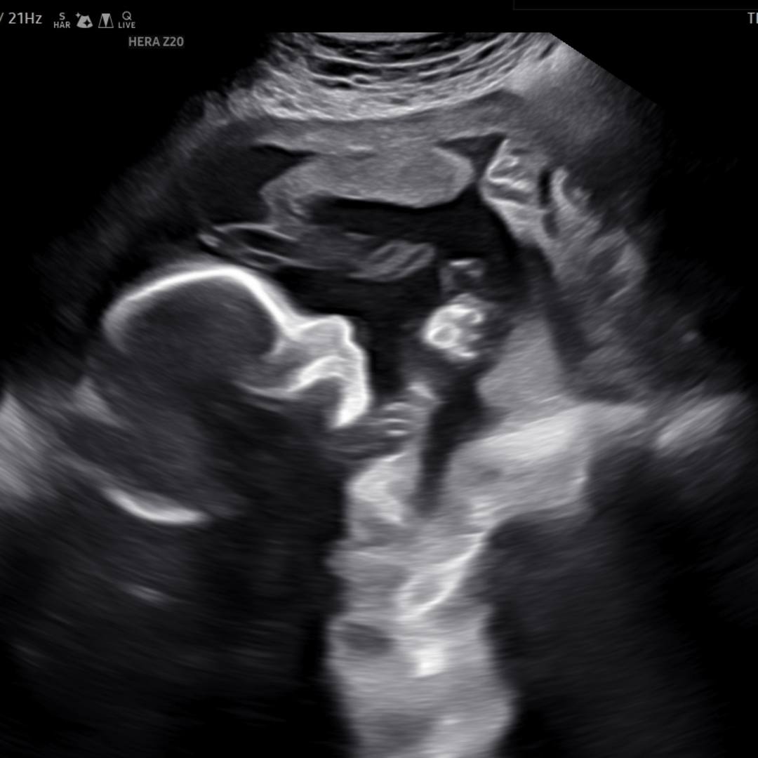 Photo shared by Ashley for their Babylist baby registry.