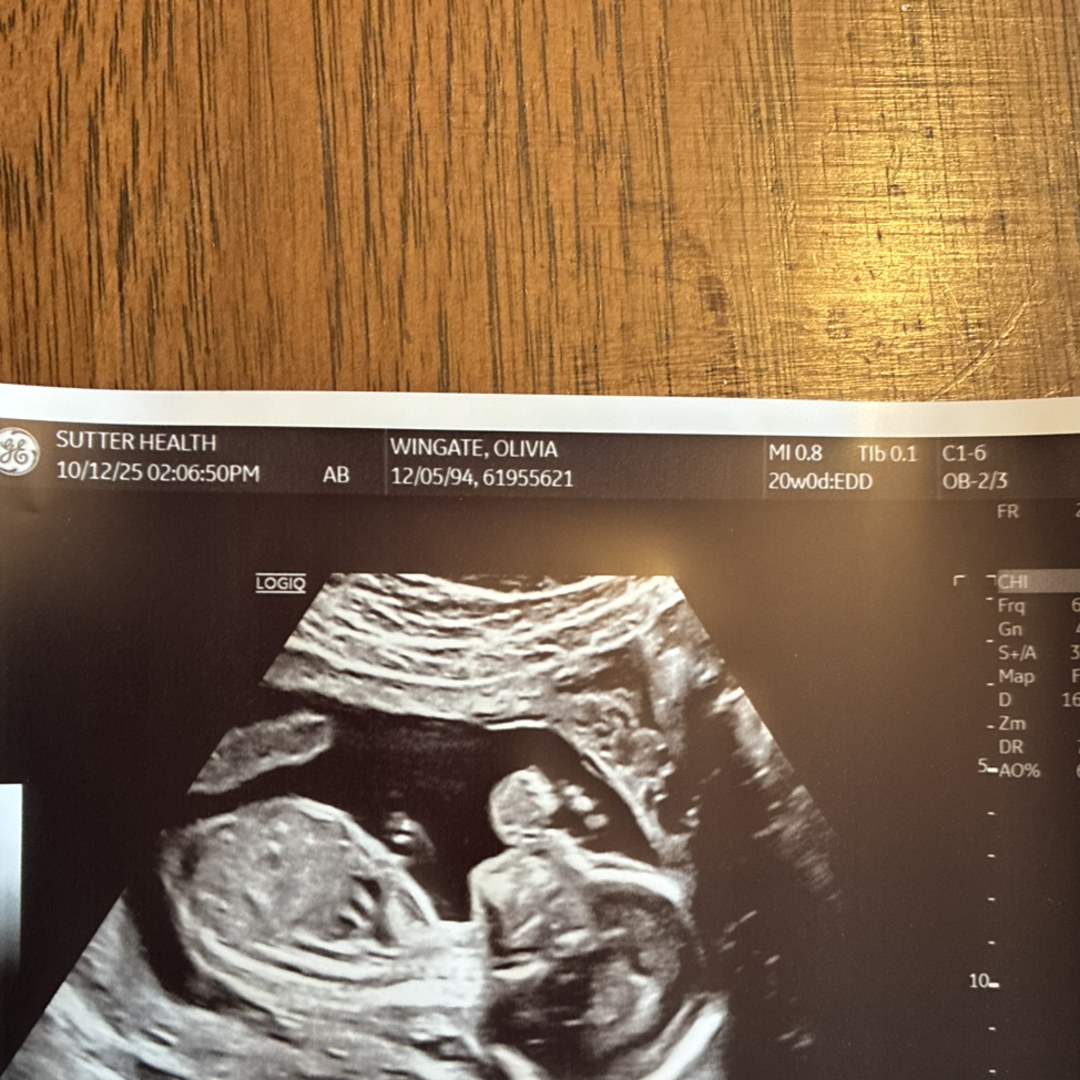 Photo shared by Olivia for their Babylist baby registry.