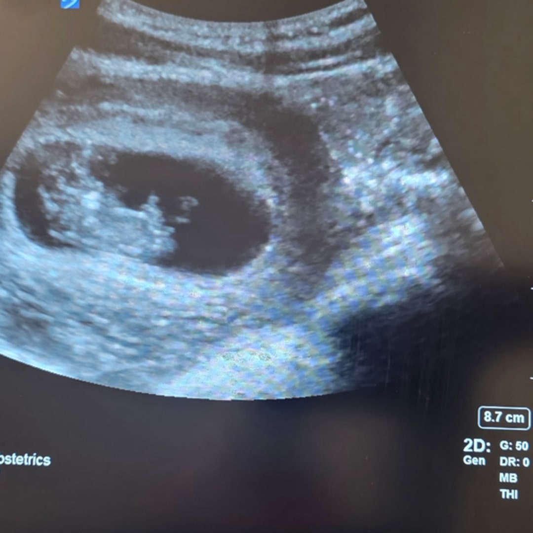 Photo shared by Akita for their Babylist baby registry.