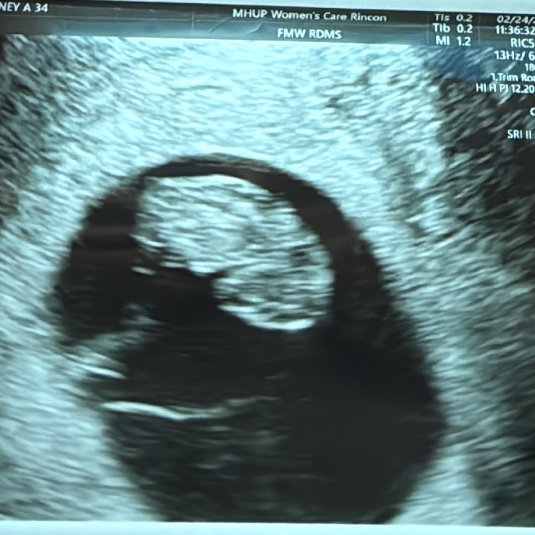 Photo shared by Sidney for their Babylist baby registry.