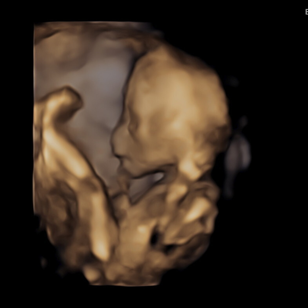 Photo shared by Rebecca for their Babylist baby registry.