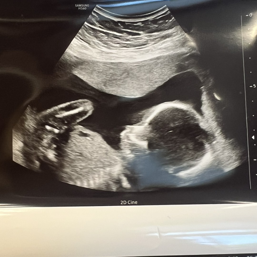 Photo shared by Brittany & Evan for their Babylist baby registry.