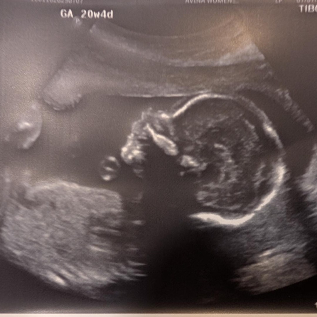 Photo shared by Laura for their Babylist baby registry.