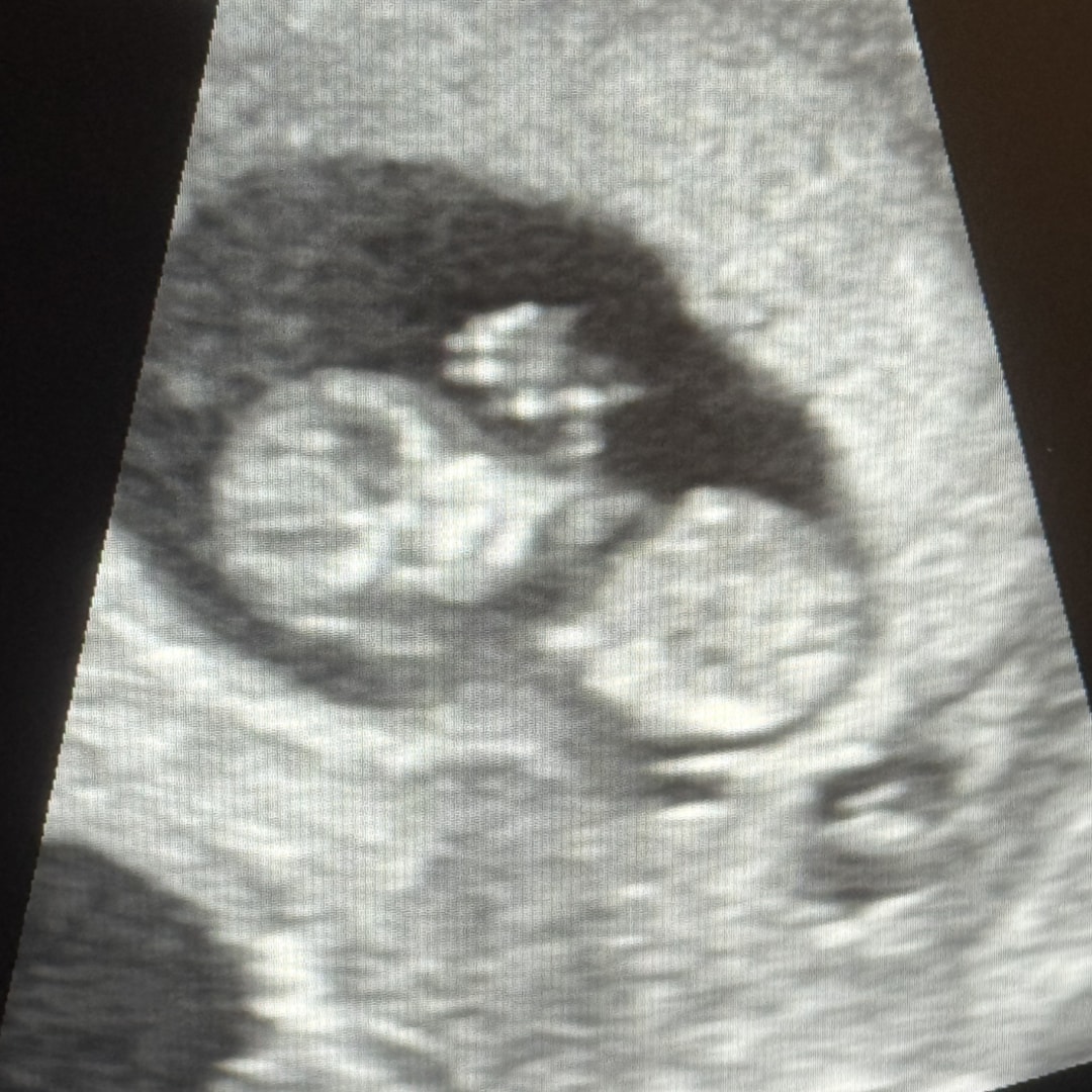 Photo shared by Sydney for their Babylist baby registry.