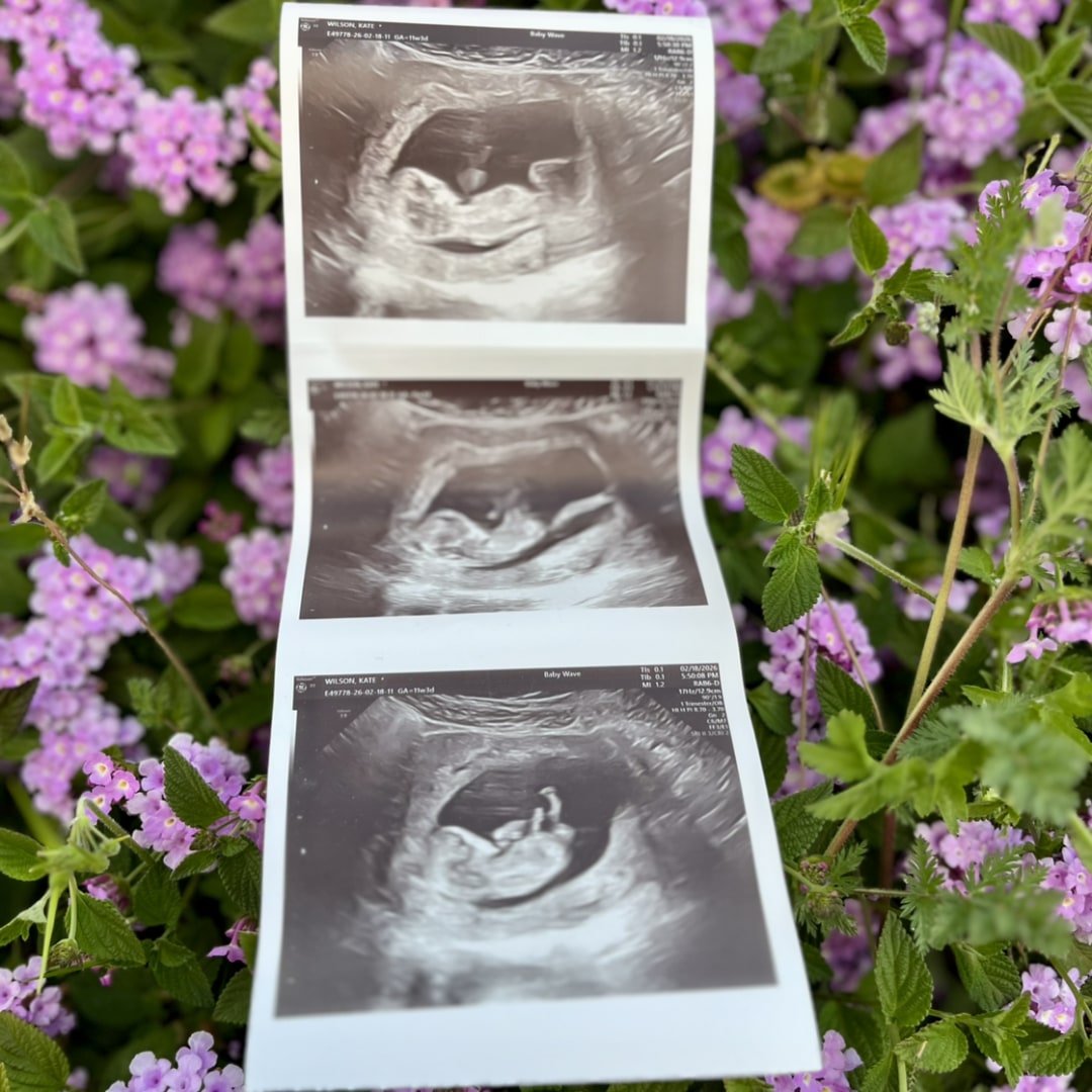 Photo shared by Kate for their Babylist baby registry.