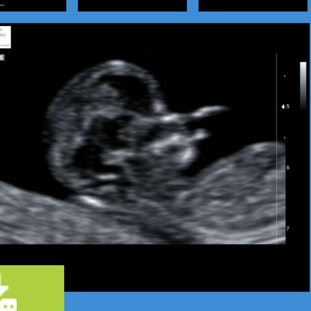 Photo shared by Eden for their Babylist baby registry.