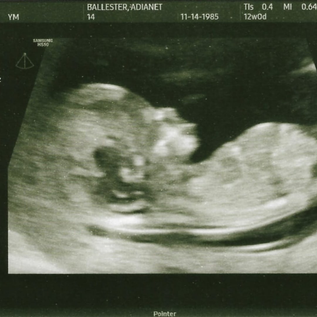 Photo shared by Adianet for their Babylist baby registry.