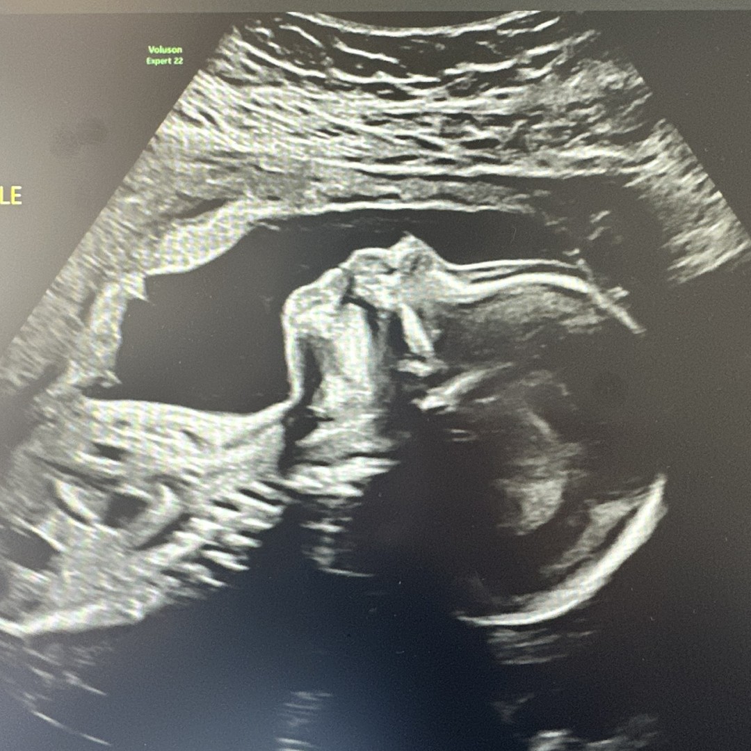 Photo shared by Ethan for their Babylist baby registry.