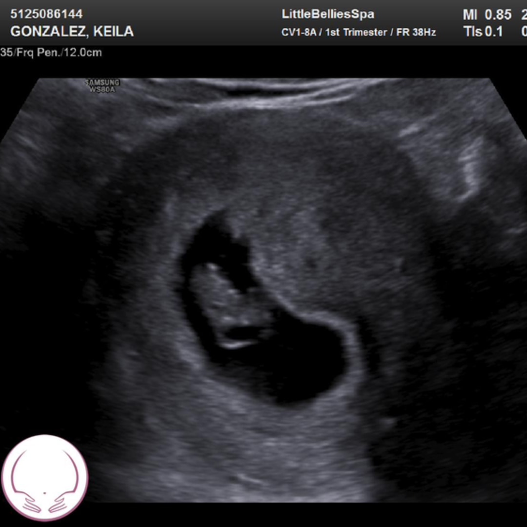 Photo shared by Keila for their Babylist baby registry.