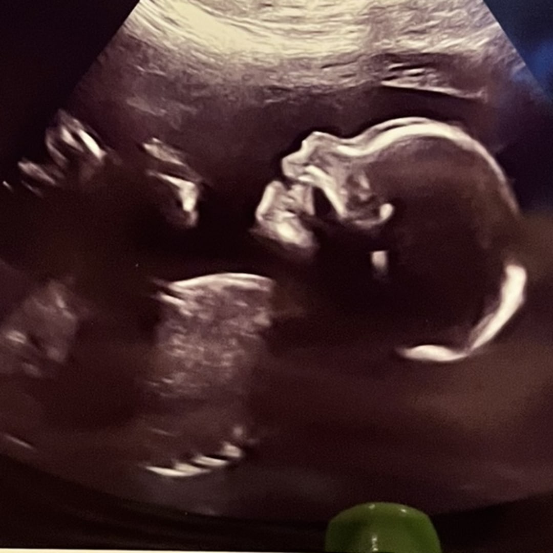Photo shared by Erika for their Babylist baby registry.