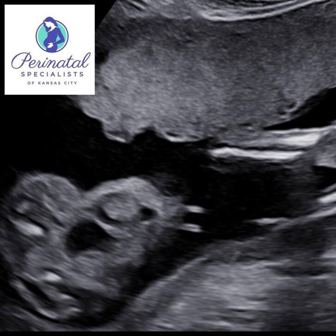 Photo shared by Ashley for their Babylist baby registry.