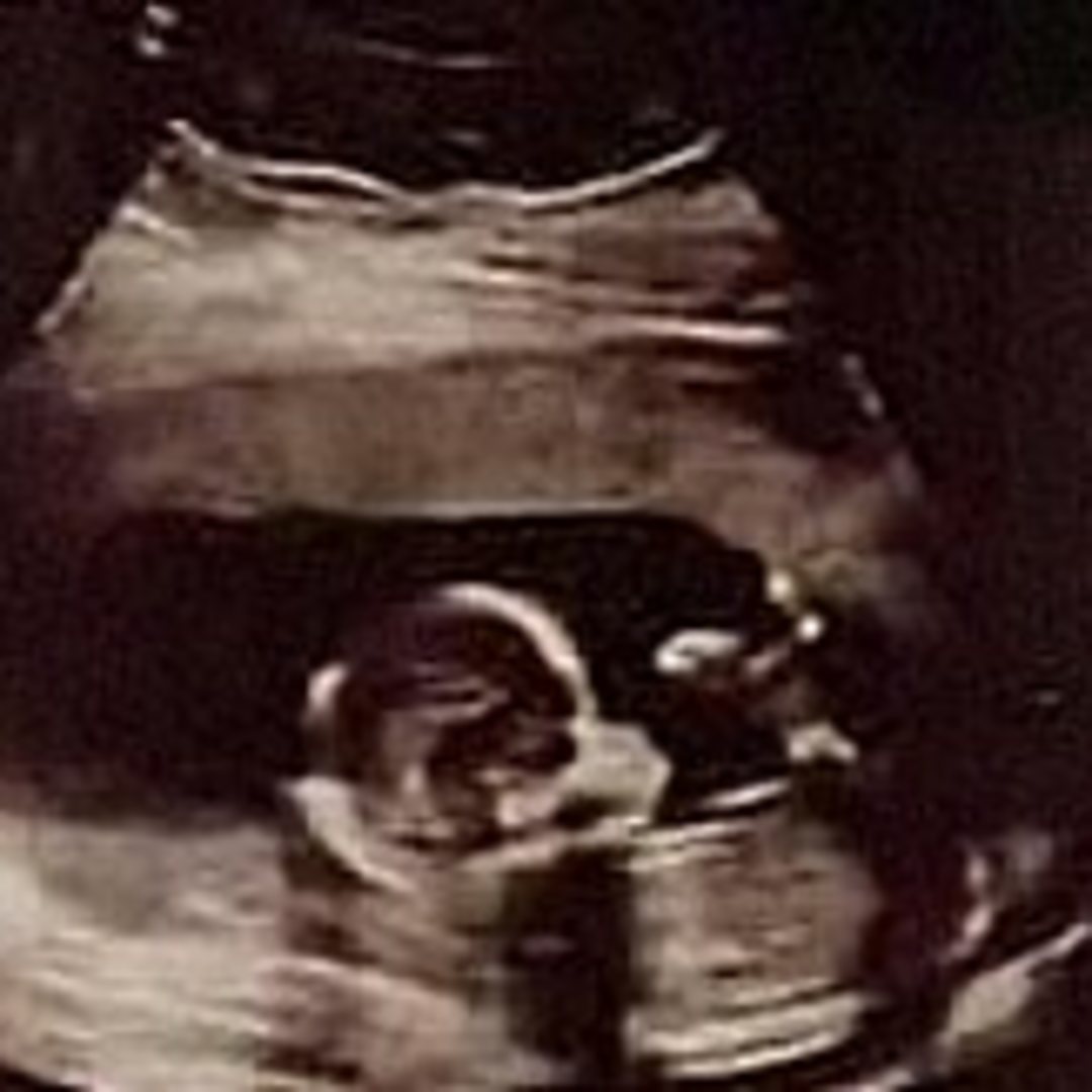 Photo shared by Atria for their Babylist baby registry.