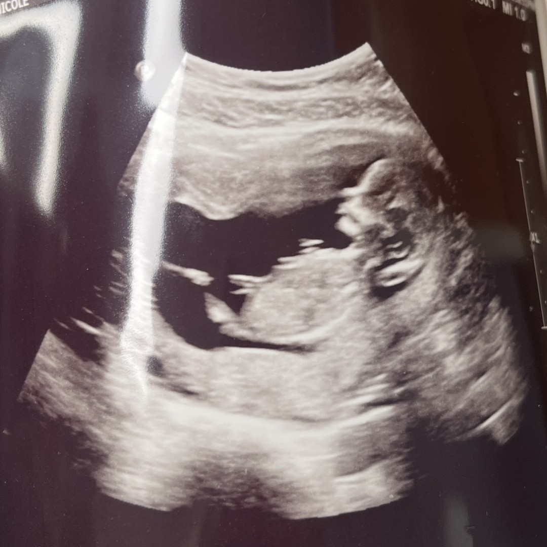 Photo shared by Dani for their Babylist baby registry.