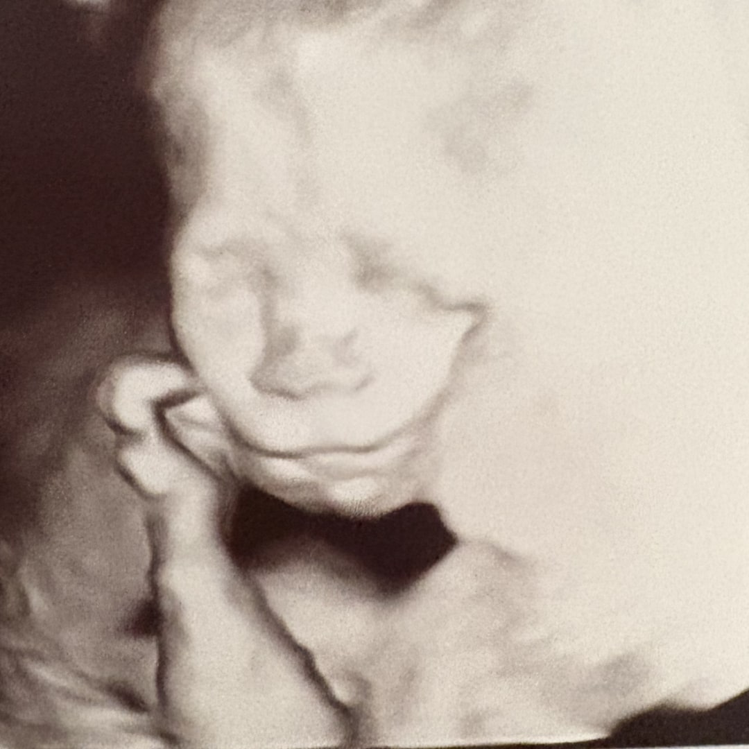 Photo shared by Emma for their Babylist baby registry.
